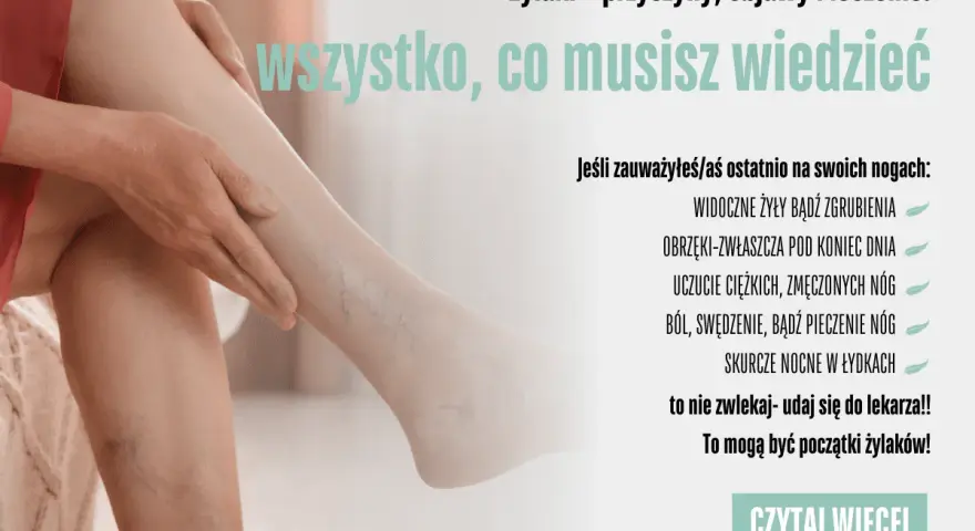 Żylaki? Jak zapobiec i cieszyć się lekkimi nogami każdego dnia