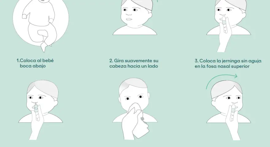 Ilustración paso a paso para el lavado nasal de un bebé. Incluye cómo colocarlo, girar su cabeza, usar la jeringa y limpiar su nariz.