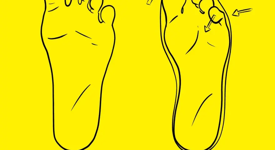 Dos pies dibujados en negro sobre fondo amarillo. Uno muestra el pie normal, el otro el pie con el segundo dedo más largo, el llamado dedo griego.