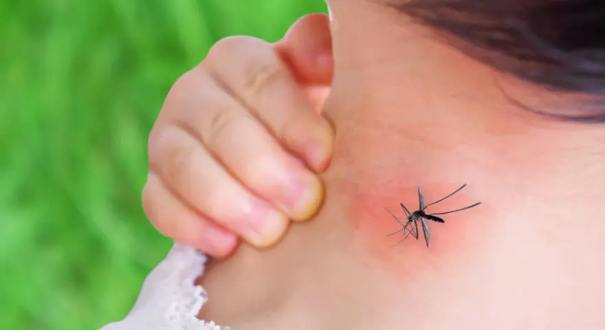 Dziecko drapie zaczerwienione miejsce na szyi po ukąszeniu komara. Rumień jest widoczny.