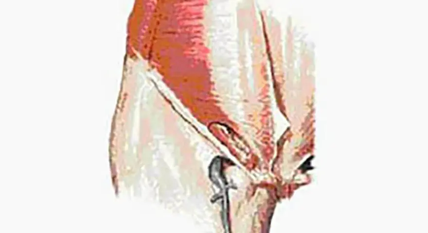 Illustration anatomique montrant la région pubienne, pertinente pour la pubalgie chez la femme.