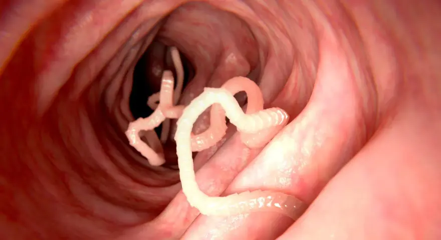 Würmer im Darm: Nahaufnahme von Parasiten, die sich in einem roten, schleimigen Darmwinden.