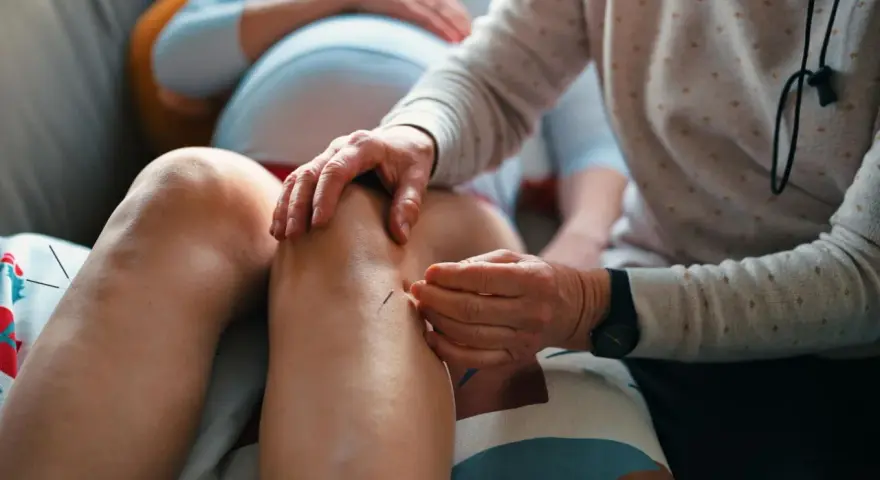 Akupunktur während der Schwangerschaft: Eine Frau erhält Nadeln am Knie zur Linderung von Beschwerden.