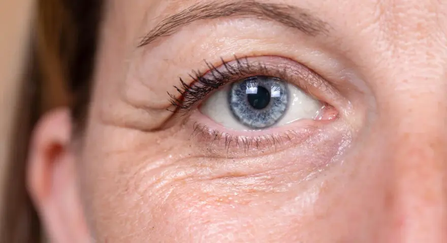 Nahaufnahme eines blauen Auges mit sichtbaren Lachfalten, die typisch für Frauen um die 40 sind.