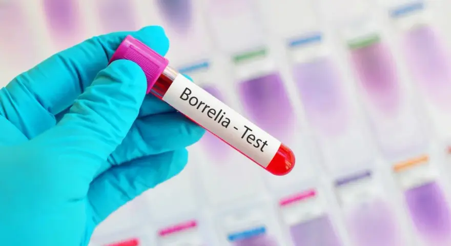 Ręka w niebieskiej rękawiczce trzyma probówkę z napisem "Borrelia - Test". To klucz do odpowiedzi, gdzie zrobić badania na boreliozę.