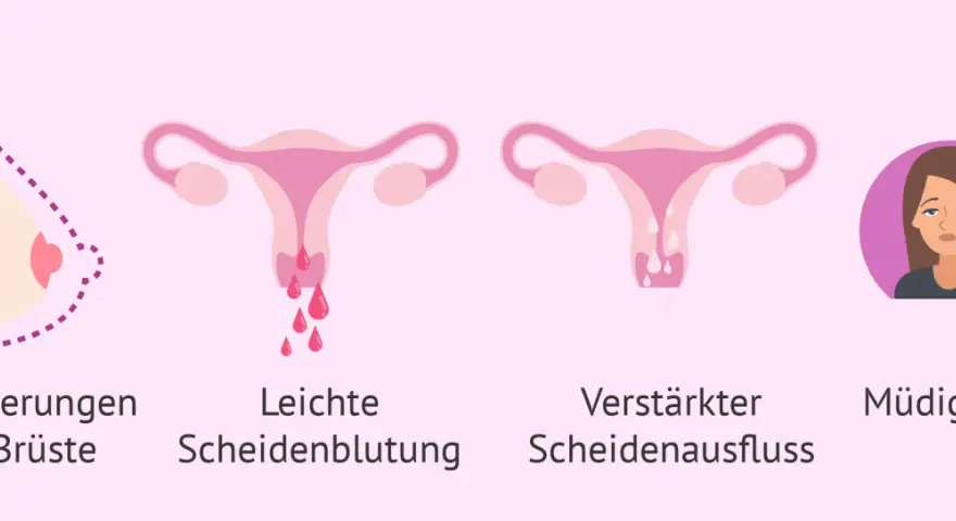 Brustveränderungen, leichte Blutungen, verstärkter Ausfluss und Müdigkeit können Anzeichen sein, dass die periode bleibt aus.