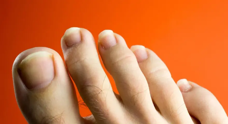 Primer plano de unos pies con uñas amarillas sobre fondo naranja.