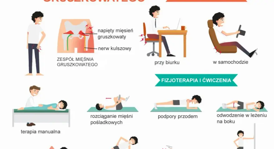 Ilustracja pokazuje zespół mięśnia gruszkowatego, jego przyczyny (długotrwałe siedzenie) i metody leczenia (fizjoterapia, ćwiczenia).