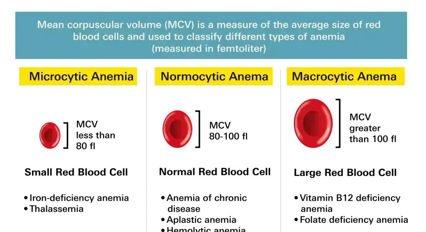 Anemia co to? Porównanie wielkości czerwonych krwinek: mikrocytarna (małe), normocytarna (normalne), makrocytarna (duże).