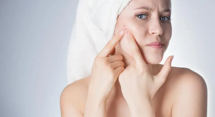 Ragazza con asciugamano in testa che si tocca il viso, preoccupata per un brufolo. La sua pelle mostra segni di imperfezioni.