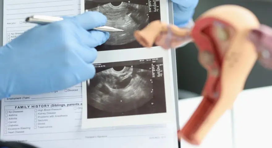 Ultraschall Frauenarzt: Kassenleistung oder IGeL? Wann sinnvoll?