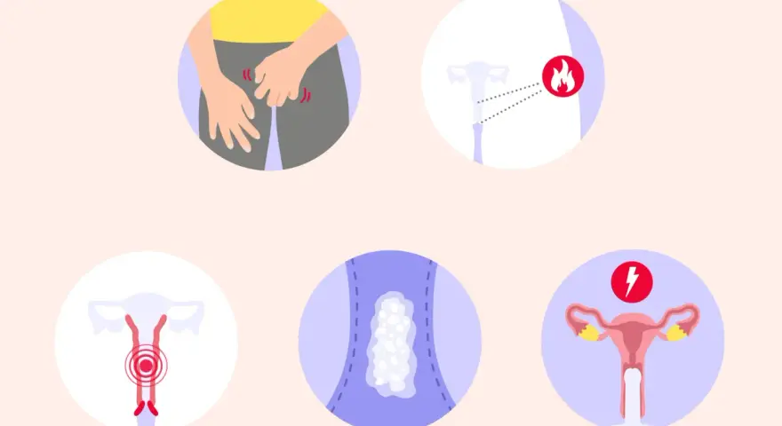 Illustrationen zeigen Juckreiz im Intimbereich, Entzündungssymptome, Ausfluss und Schmerzen. So sieht scheidenpilz aus.