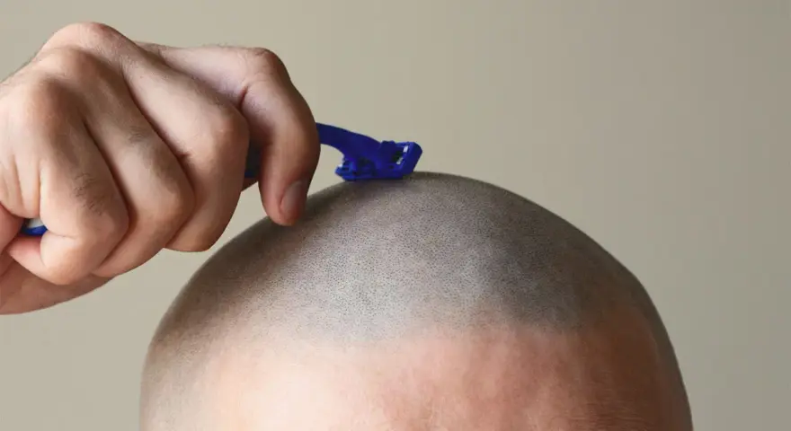 Mano con maquinilla azul afeitándose la cabeza, dejando la piel suave y sin vello.
