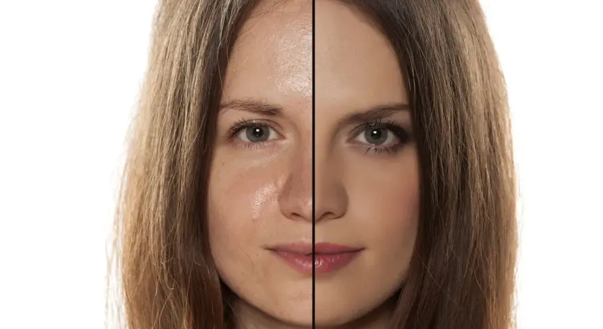 Viso diviso: a sinistra pelle con sebo e imperfezioni, a destra pelle uniformata dal trucco.