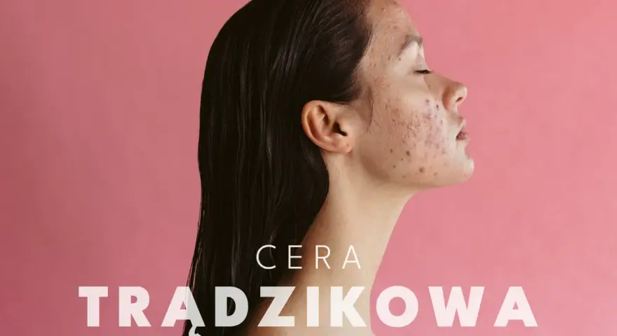 Profil kobiety z cerą trądzikową. Dowiedz się, jak dbać o cerę trądzikową i odzyskać jej zdrowy wygląd.