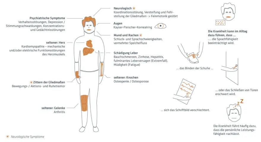 Morbus Wilson Diagnose: Schritte, Tests & Symptome erklärt