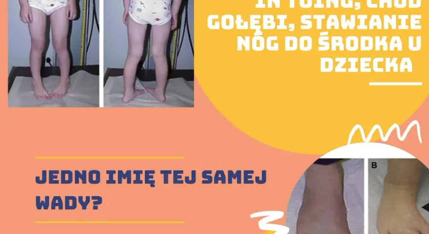 Dziecko z zaburzeniami chodu: "chod gołębi", "stawianie nóg do środka". Czy to ta sama wada?