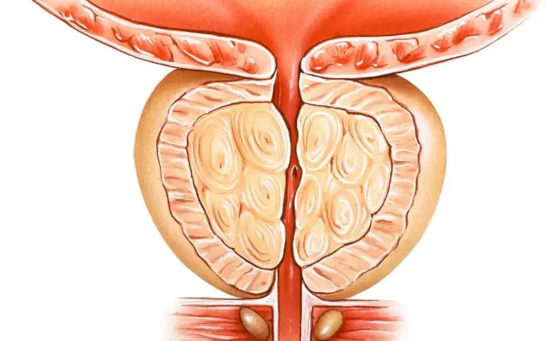 Masaż prostaty jak wykonać: bezpieczne techniki i ważne wskazówki
