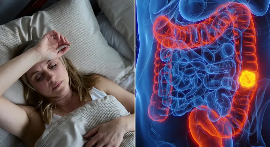 Frau im Bett, besorgt. Daneben eine 3D-Darstellung des Darms mit einem leuchtend gelben Tumor. So fing Darmkrebs an.