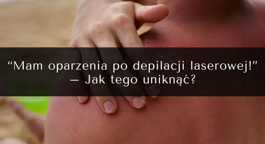 Oparzenia po depilacji laserowej to częsty problem. Zobacz, jak uniknąć powikłań i jakie są opinie o zabiegu.