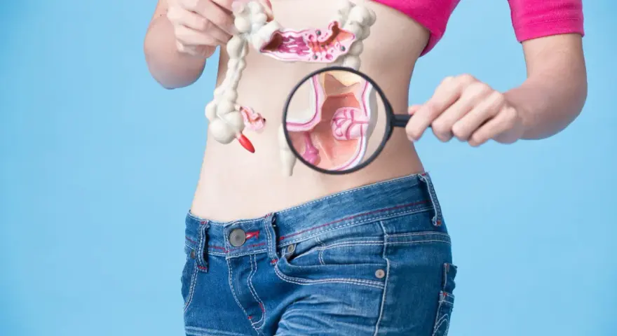 Model jelita z powiększeniem na uchylki esicy. Jak leczyć te schorzenia?