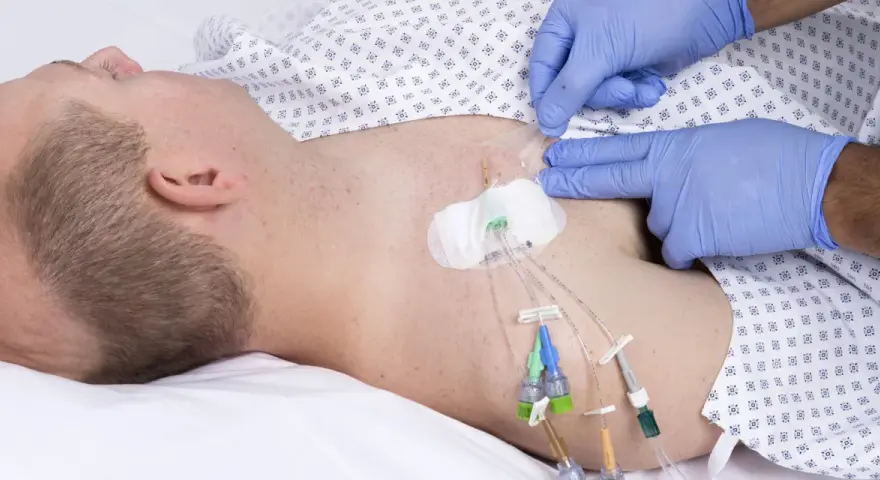 Ein Arzt mit blauen Handschuhen sichert einen zentralen Venenkatheter (pvk medizin) bei einem liegenden Patienten.