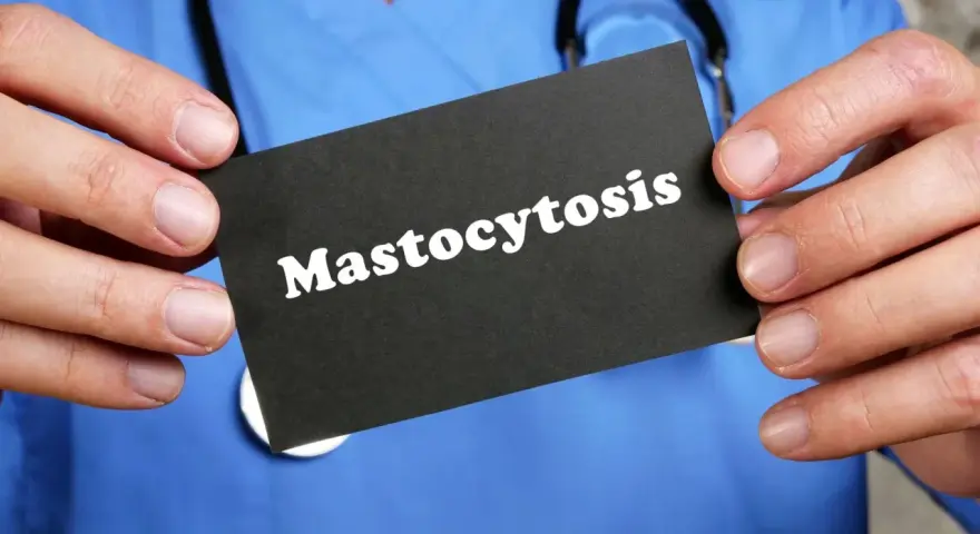 Lekarz w niebieskim kitlu trzyma kartę z napisem "Mastocytoza".