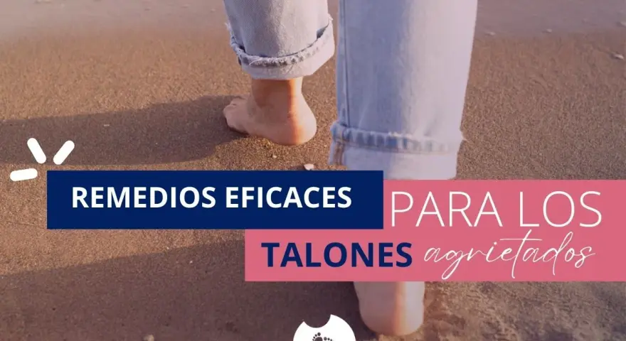 Remedios eficaces para talones agrietados. Pies descalzos caminan sobre la arena, buscando alivio para las heridas en el talón del pie.