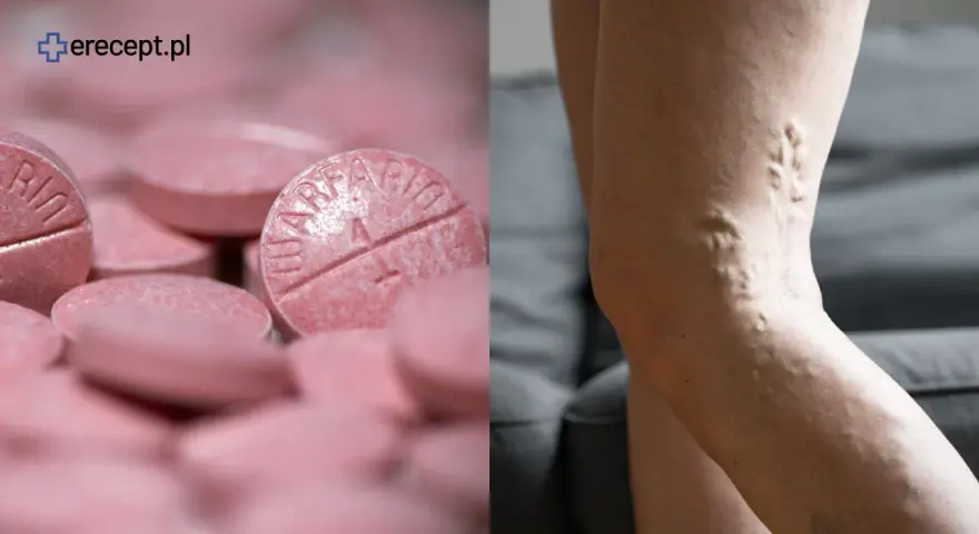 Leki rozrzedzające krew a witamina K: jedz bezpiecznie i stabilnie!