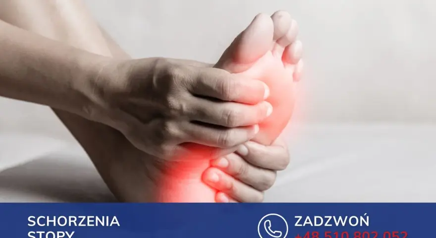 Dłoń uciska bolesną stopę, sugerując problem ze stopą Mortona.
