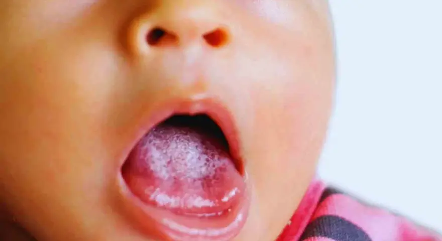 Primo piano del volto di un neonato con la bocca aperta, mostrando il palato bianco e la lingua rosa.