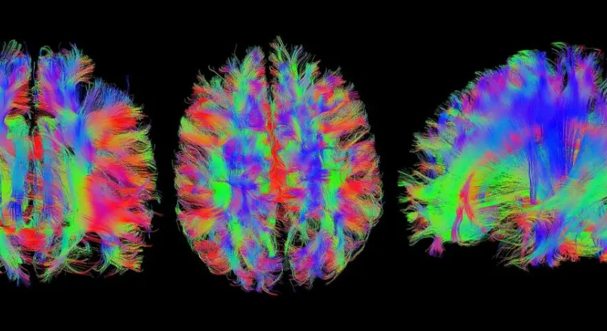 Bunte Faserbahnen des Gehirns, die die komplexen Verbindungen für kognitive Wissenschaft darstellen.