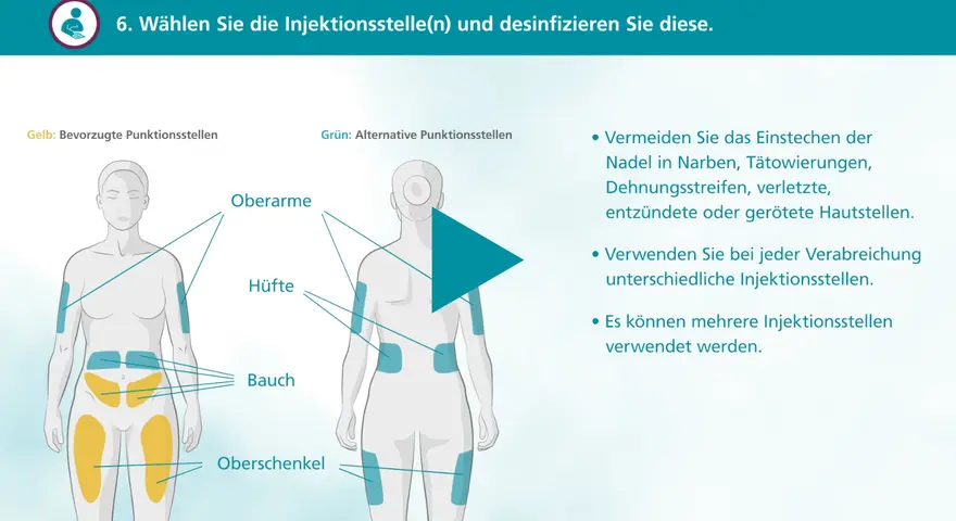 Illustration zeigt bevorzugte (gelb) und alternative (grün) Injektionsstellen am Körper, z.B. Oberschenkel.