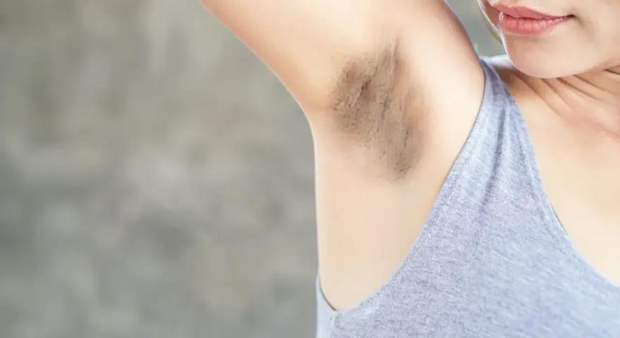 Primer plano de una axila con manchas oscuras y vello visible.