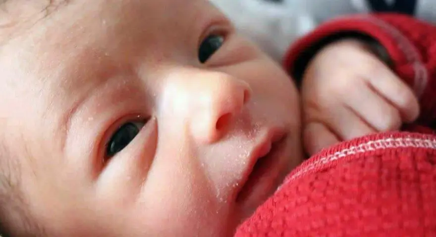 Primo piano del viso di un neonato con crosta lattea. La sua manina è appoggiata su una coperta rossa.