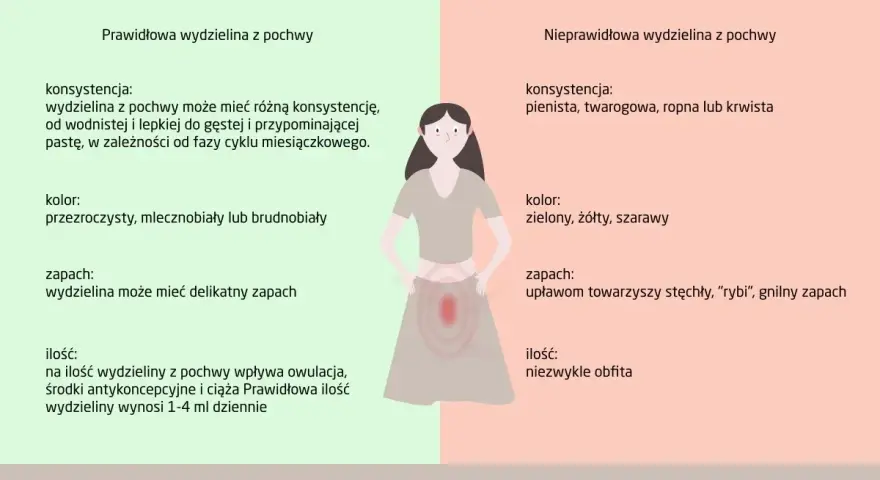 Prawidłowa wydzielina z pochwy w ciąży jest wodnista lub gęsta, przezroczysta lub mlecznobiała. Nieprawidłowa wydzielina może być pienista, żółta, zielona, o nieprzyjemnym zapachu.