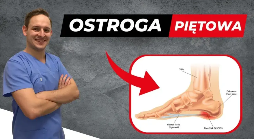 Ostroga piętowa: 5 ćwiczeń, które pokonają ból pięty!