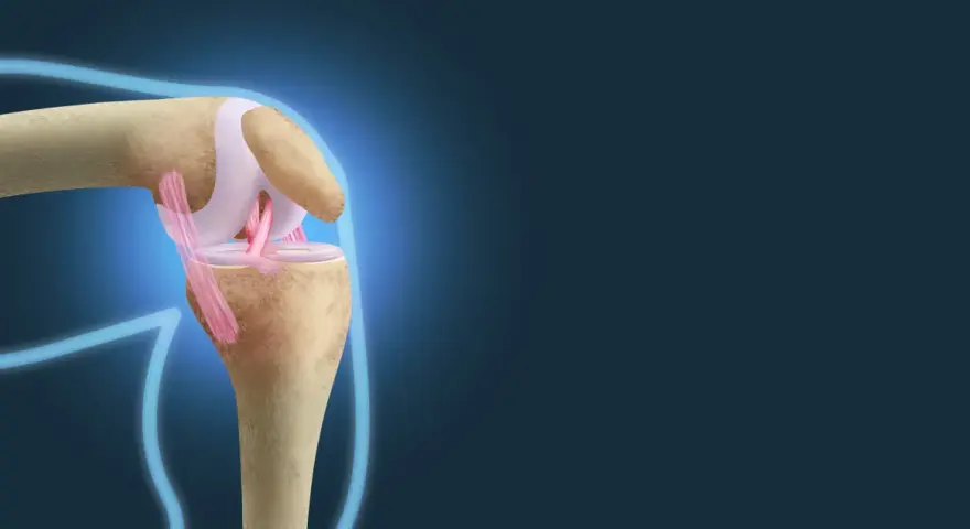 Ilustracja anatomiczna stawu kolanowego z widocznymi więzadłami i kośćmi.