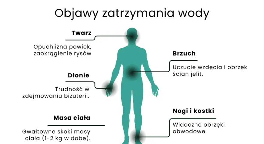 Objawy zatrzymania wody w organizmie: opuchlizna twarzy, trudność w zdejmowaniu biżuterii, wzdęcia, nagłe skoki wagi, obrzęki nóg i kostek.