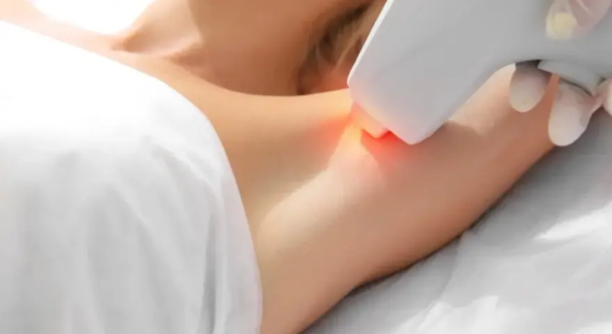 Epilacja laserowa co to – skuteczna metoda trwałego usuwania włosów