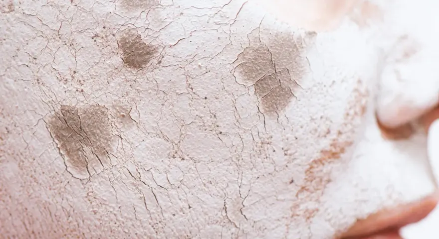 Textura agrietada de una mascarilla de arcilla sobre la piel, mostrando cómo protege la barrera cutánea.