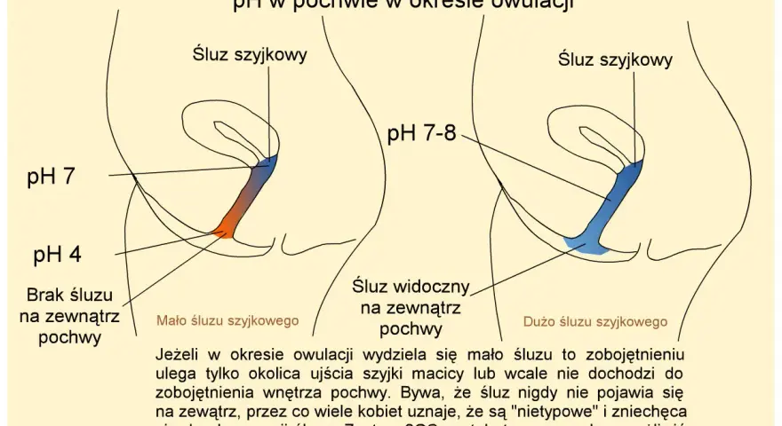 Ilustracja pokazuje śluz szyjkowy w pochwie podczas owulacji. Po lewej mało śluzu, po prawej dużo śluzu.