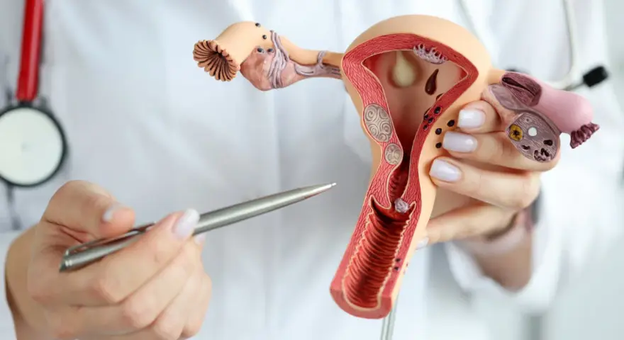 Model anatomiczny narządów rodnych kobiety z widocznym tyłozgięciem macicy i mięśniakami. Lekarz wskazuje na zmiany.