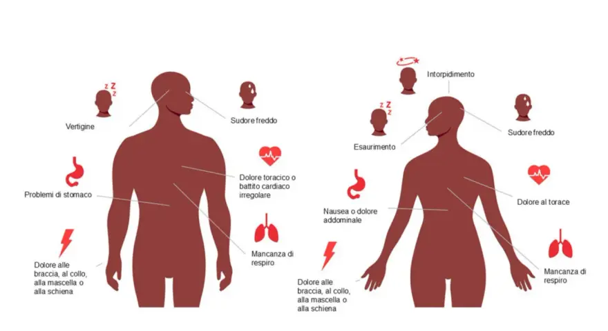 Sintomi infarto da stress: vertigini, sudore freddo, dolore toracico, nausea, intorpidimento, dolore a braccia/collo/mascella/schiena.