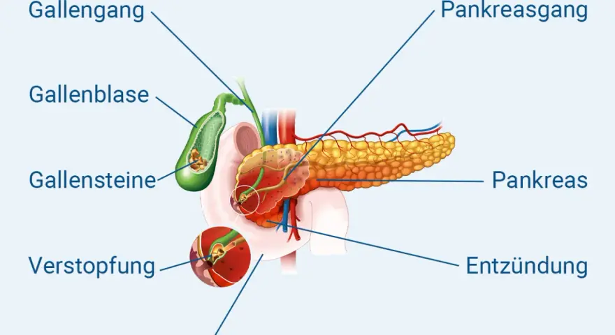 Chronische Pankreatitis: Diagnose-Schritte & Symptome erklärt