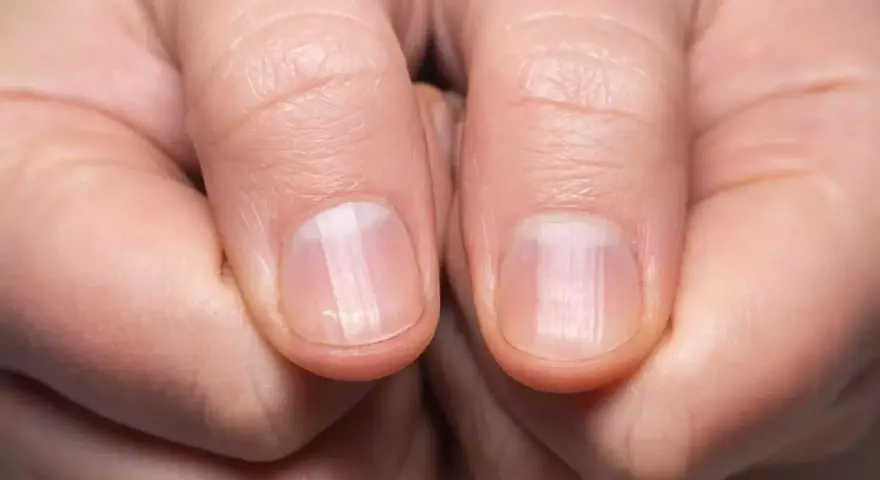 Des ongles fragiles ? Découvrez comment durcir les ongles recette de grand-mère pour des mains sublimes.
