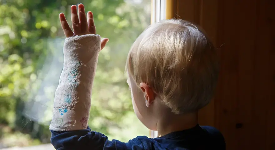 Kind mit Gips am Arm, das durch ein Fenster schaut. Ein gebrochenes Handgelenk bei einem Kind ist schmerzhaft, aber die bunte Gipsbinde macht es erträglicher.