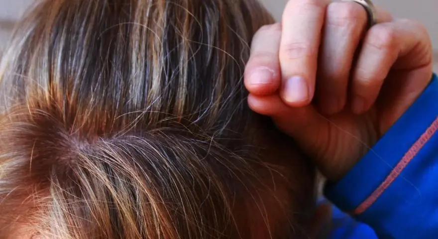 Dita che tirano i capelli, un gesto comune nella tricotillomania, a volte associata all'autismo.