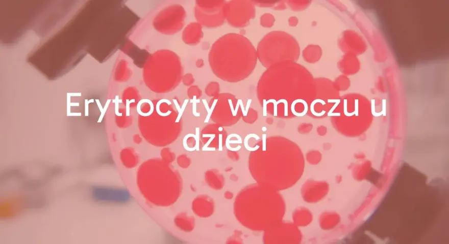 Badanie moczu: ogólne czy posiew? Zrozum różnice i diagnozę