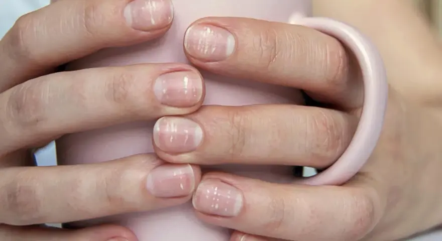 Mani con unghie deboli e striature bianche, che sorreggono una tazza rosa. Cosa fare per rinforzarle.